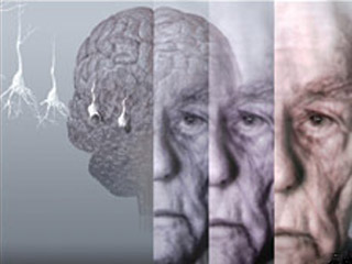 В 2013 году начнутся испытания лекарства от болезни Альцгеймера