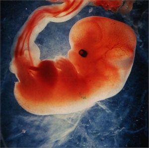 Аборты: кому нужен срок для раздумий? 
