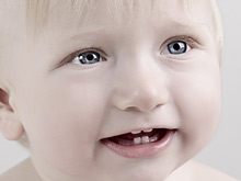 Нехорошие молочные зубы приводят к искривлению зубов во взрослом возрасте