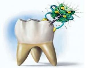 Причины боли в запломбированном зубе