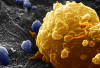 Наночастицы бисмута позволяют убивать рак меньшими дозами излучения