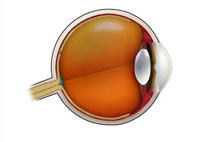 Связанная с глаукомой утрата зрения может увеличить риск автомобильных аварий