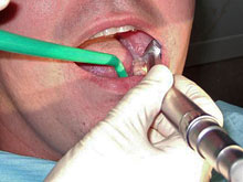 Лечение зубов - серьезное вмешательство, не терпящее халатности