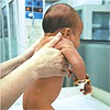 О контроле свойства медицинской помощи детям первого года жизни при хирургических заболеваниях