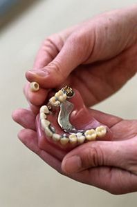 American Dental Association предупреждает: кремы для фиксации зубных протезов могут быть небезопасны для здоровья! 