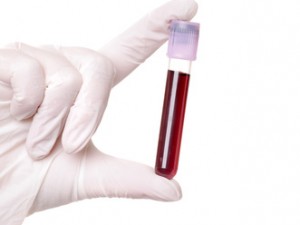 В первый раз образец пуповинной крови из России будет использован для спасения жизни иностранного пациента