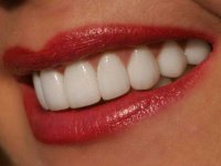 Особенности и разновидности отбеливания зубной эмали