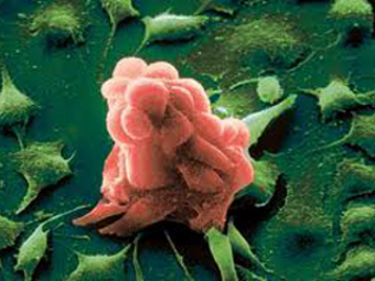 Впервые подтверждено существование раковых стволовых клеток