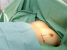 Клеточная технология позволит создать женскую грудь с нуля
