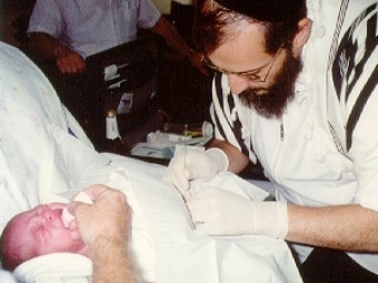 Израильскому мальчику спас зрение обряд обрезания