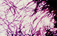 Пищеварительные бактерии производят нейротрансмиттер, который может играть роль в воспалении