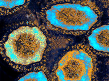 Вскрытие показало, почему коронавирус с Ближнего Востока столь опасен