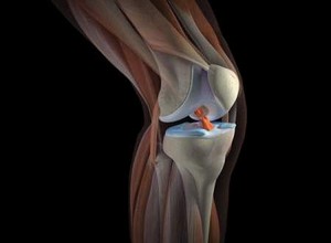 Артроскопическая хирургия коленного сустава