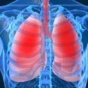GlaxoSmithKline получила право на препараты-кандидаты для лечения бронхиальной астмы и ХОБЛ компании Vectura 