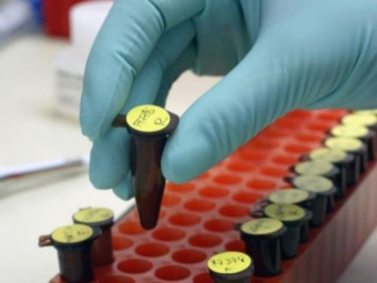 Минздрав запретит использовать биотехнологии для клонирования человека