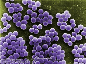Американцы смогли преодолеть антибиотикоустойчивость супермикроба