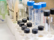 Ученые готовятся испытать вакцину, предотвращающую заражение ВИЧ