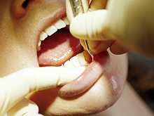 Кабинет дантиста может быть источником опасных инфекций, предупреждают эксперты