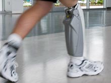 Первый в миру бионический коленный протез представили в Лондоне