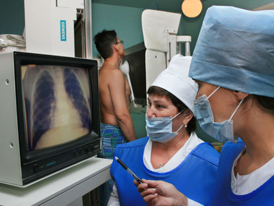 Половина российских противотуберкулезных диспансеров не соответствуют санитарным нормам.