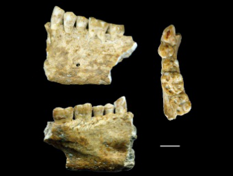 Древнейший запломбированный зуб сто лет пролежал в итальянском музее