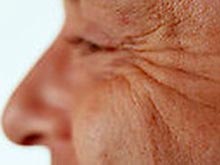 Косметические процедуры по устранению морщин грозят снижением эмоционального фона