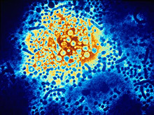Наркоманы - двигатель эпидемии гепатита С, показала компьютерная модель