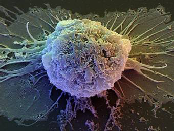 В США противники исследования эмбриональных стволовых клеток снова обратились в суд