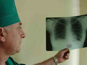 В Карелии возрастает количество больных туберкулезом с запущенными и лекарственно устойчивыми формами заболевания