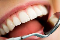Лазерное отбеливание зубов: честные ответы на каверзные вопросы