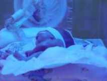 Медики спасли новорожденного с помощью охлаждения