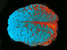 1-ая в мире полная модель мозга показывает, насколько пластичен организм