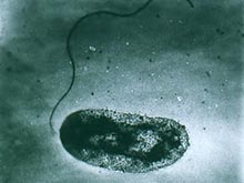 У берегов США начал размножаться опасный патоген, предупреждают специалисты