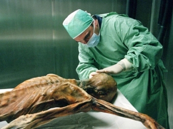 Предки современного человека также страдали от забитых артерий