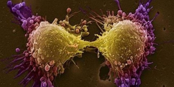 Ученые нашли ген-переключатель между «мужским» и «женским» раком