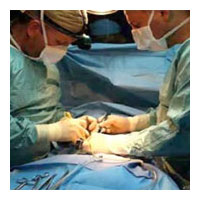 Аппендэктомия: операция аппендицит
