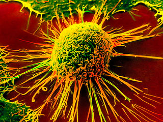 Новое в онкологии: электрошокером – по раковой опухоли