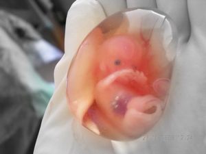 Европа против экспериментов с эмбрионами! 