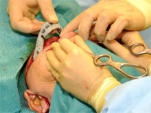 Ученые опробовали на пациенте первый в мире имплантат челюсти
