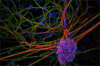 Неврологи обнаружили ключевой белок, ответственный за защиту нервной клетки