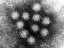 Британские специалисты опасаются массовой вспышки норовируса