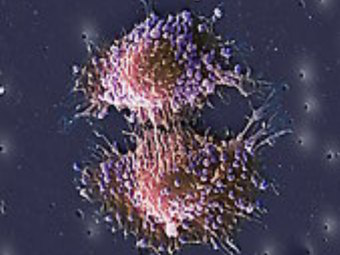 Отысканный на поверхности раковых клеток белок помог доставить лекарство в опухоль