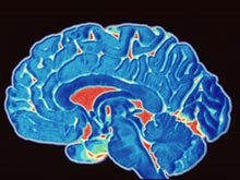 Сенсация: ученые разгадали секрет развития болезни Альцгеймера
