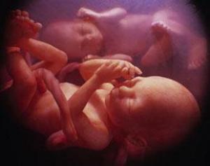 Рак связан с эмбриональным развитием, заявили ученые