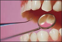 Медики научились определять болезнь костей по зубам