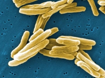 Смертность от туберкулеза в Рф снизилась за год на семь процентов