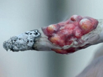 Британских курильщиков испугают больными раком сигаретами