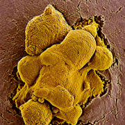 «Всемогущие» стволовые клетки оказались похожи на раковые