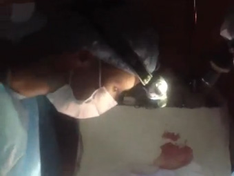 Прооперировавших пациентку при свете фонариков врачей проверит сахалинский Минздрав