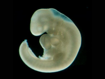РПЦ предложила Минздраву считать эмбрионы людьми